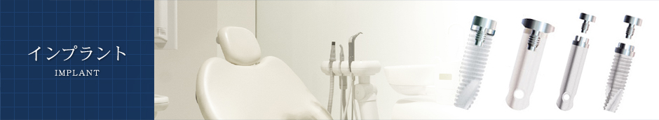 �C���v�����g