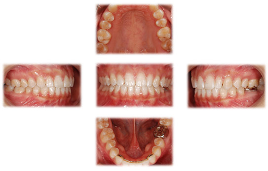 ���o���ʐ^