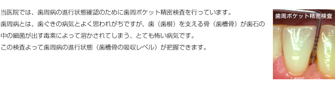 �����a�|�P�b�g��������(6�_�@)�ɂ���