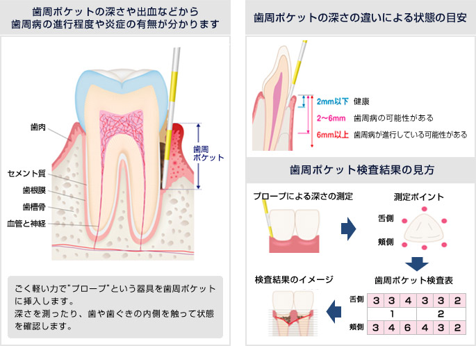 �����a�|�P�b�g��������(6�_�@)�ɂ���