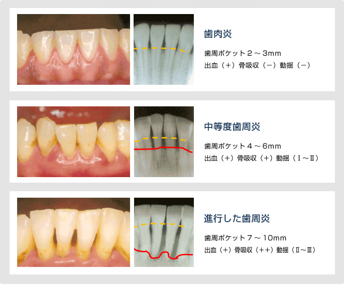 �����a�̏�Ԃɂ���