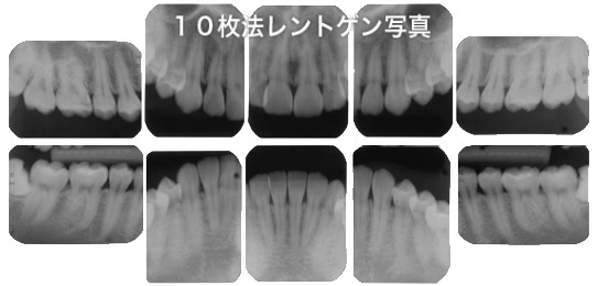 10���@�f���^�������g�Q���ʐ^