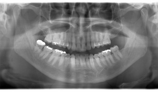 �p�m���}�����g�Q���ʐ^