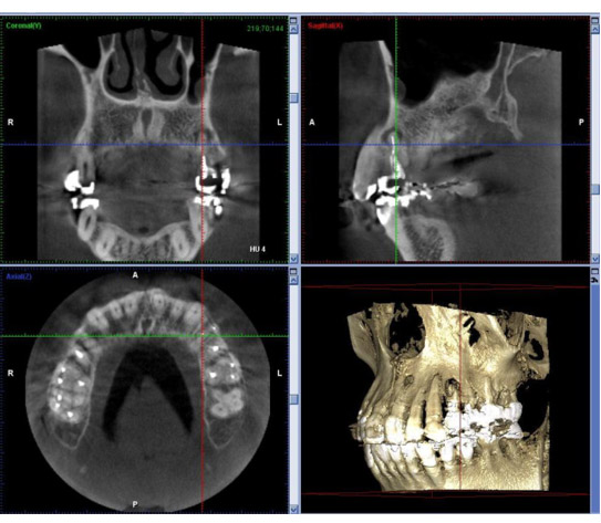 ���ȗp�b�s�ɂ��R�c�����g�Q���ʐ^